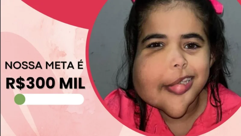 Maya nasceu com uma condição rara e precisa da nossa ajuda para viver com dignidade 💚