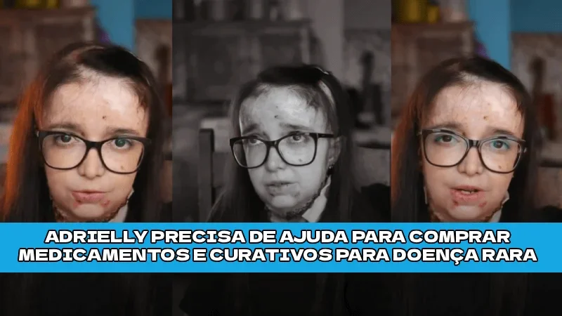 Ajude Adrielly a Vencer a Epidermólise Bolhosa